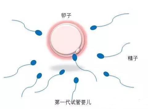 找卵代生子机构